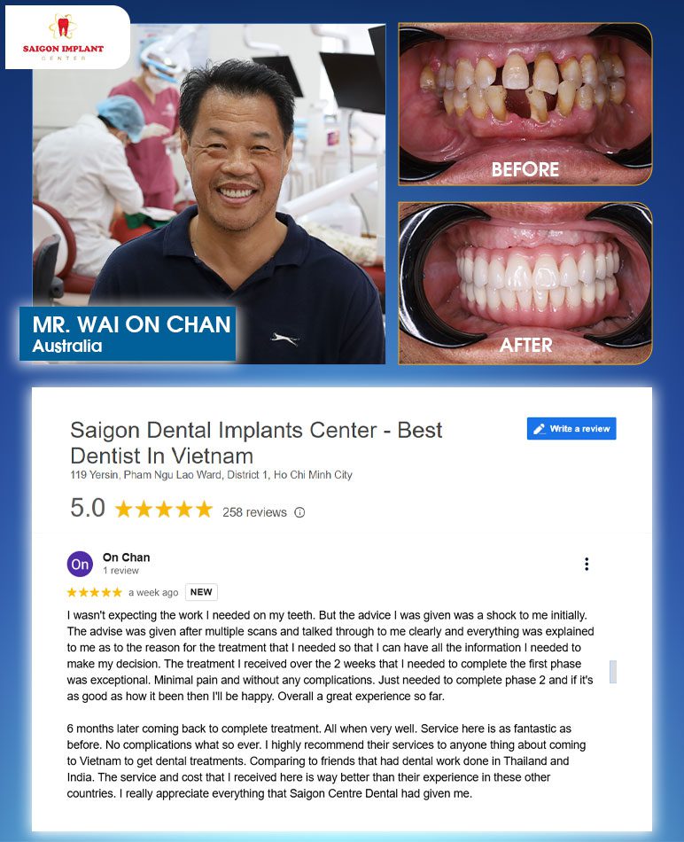 dental treatment in vietnam