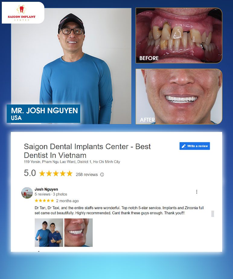 customer reviews