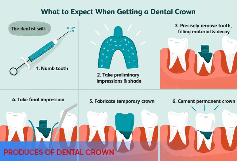 process of dental crown