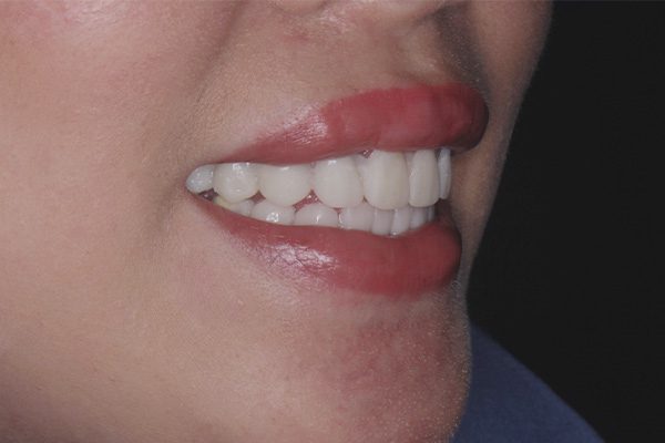 Before image