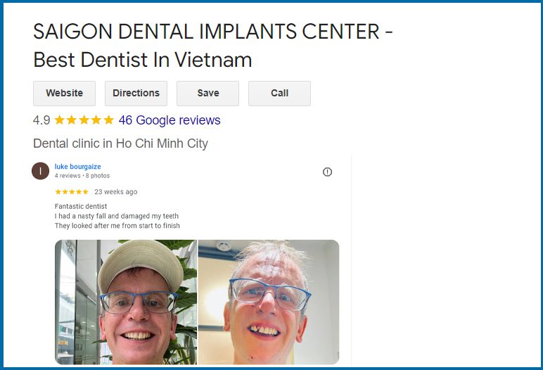 Dental crowns