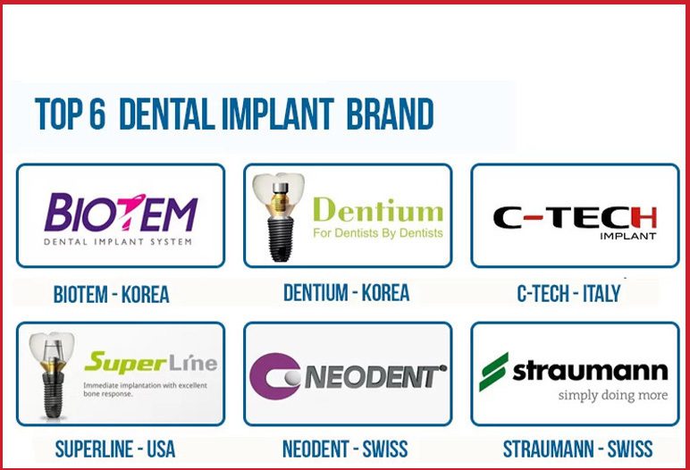 implants brands