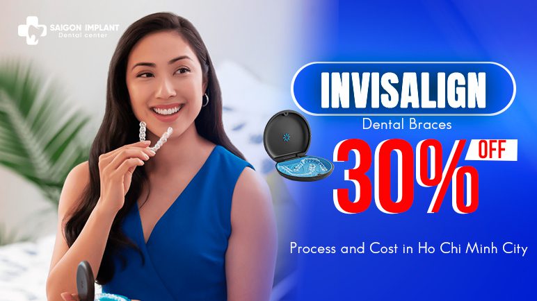 invisalign dental braces