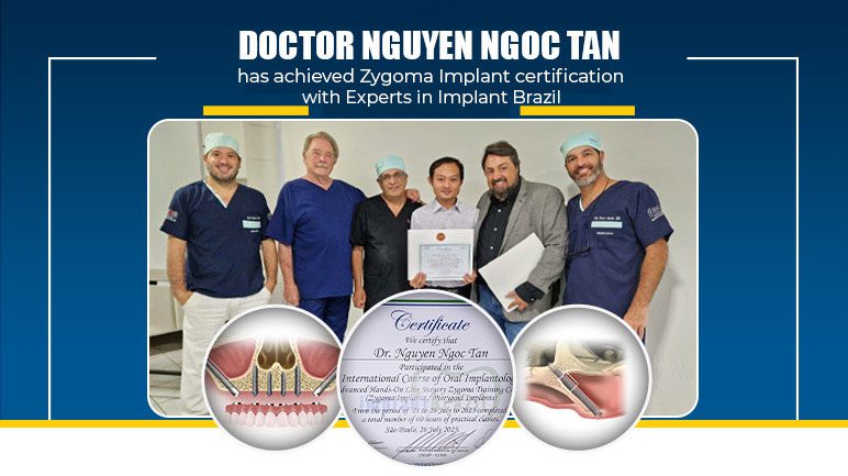 zygoma implant