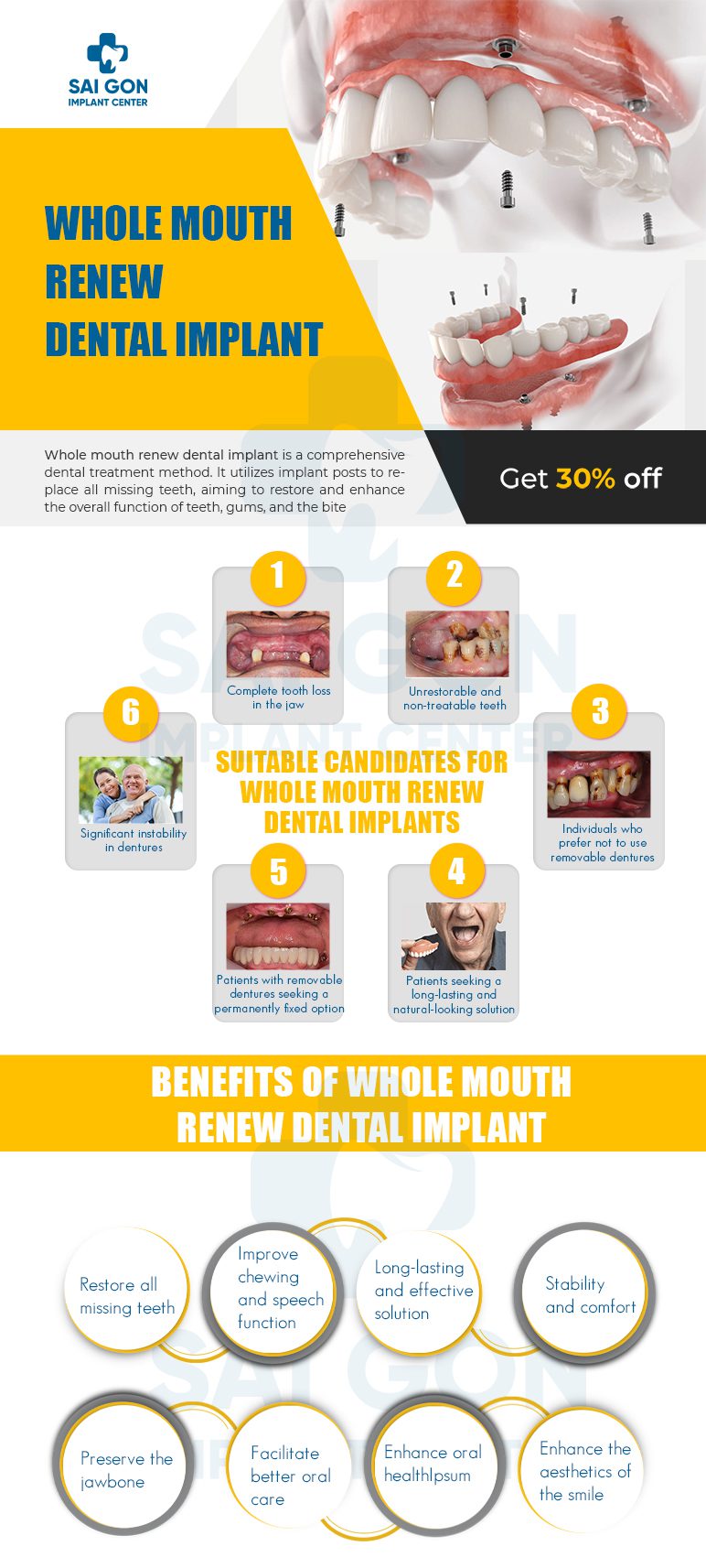 whole mouth reconstruction dental implant
