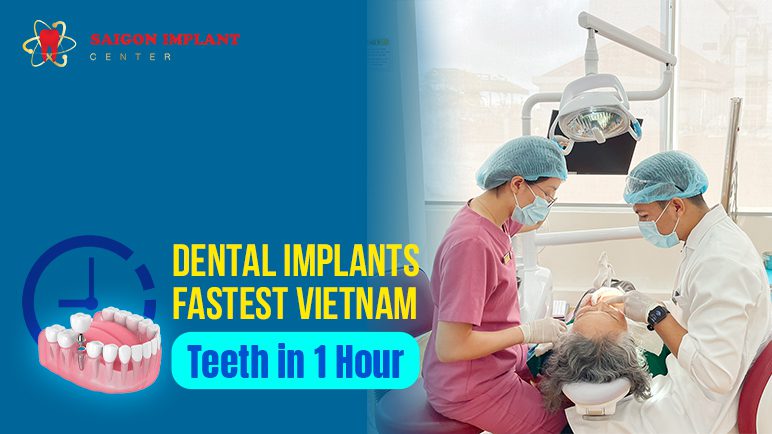 dental implants fastest vietnam