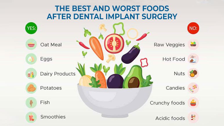 Eat soft foods after dental implants surgery