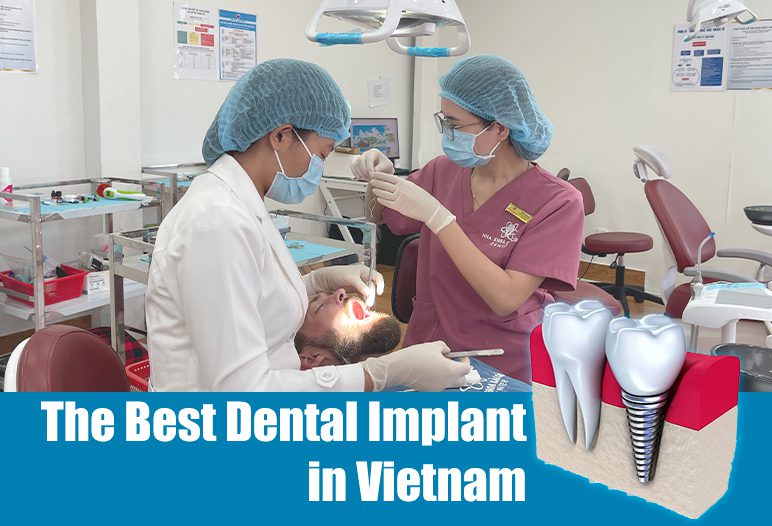 best dental implant in vietnam
