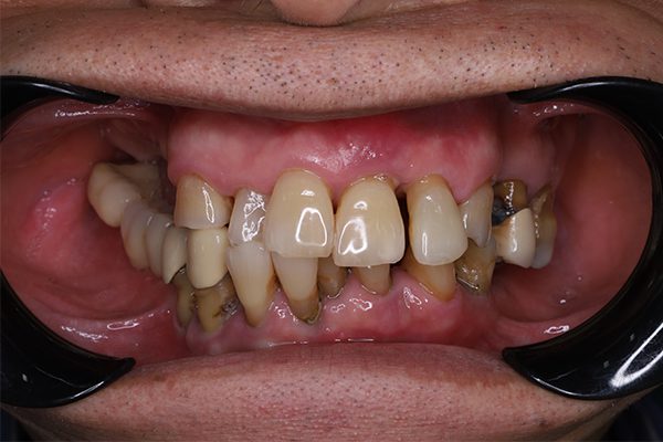 Before image