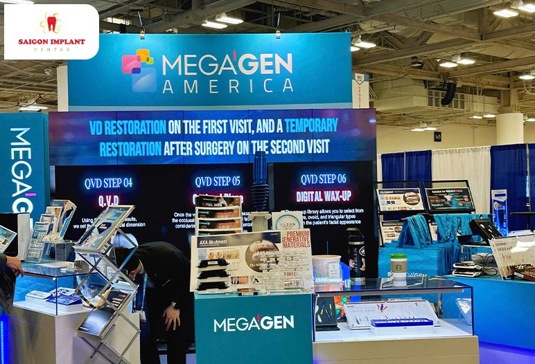 Exhibition of World-Renowned Implant Brands: Megagen America