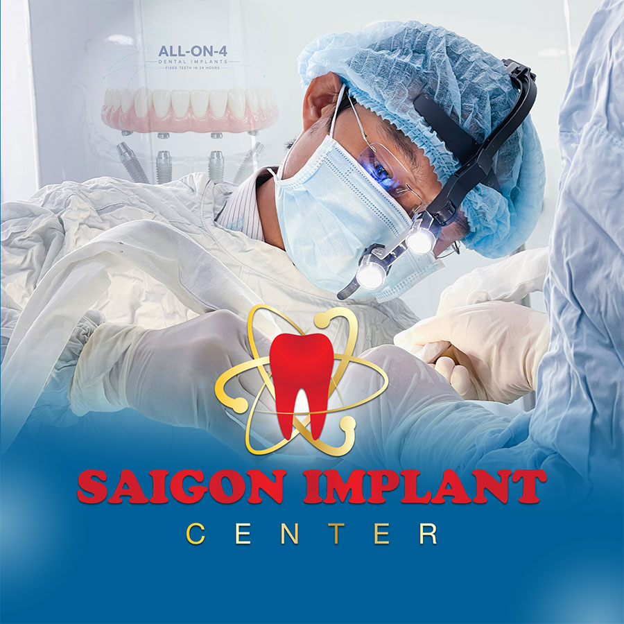 best dentist implant vietnam
