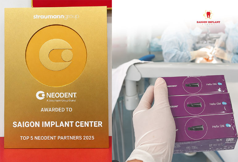 best implant