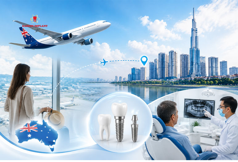 Dental Implant Journey dental implant tourism