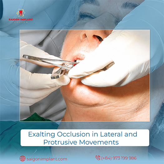 dental implant 
