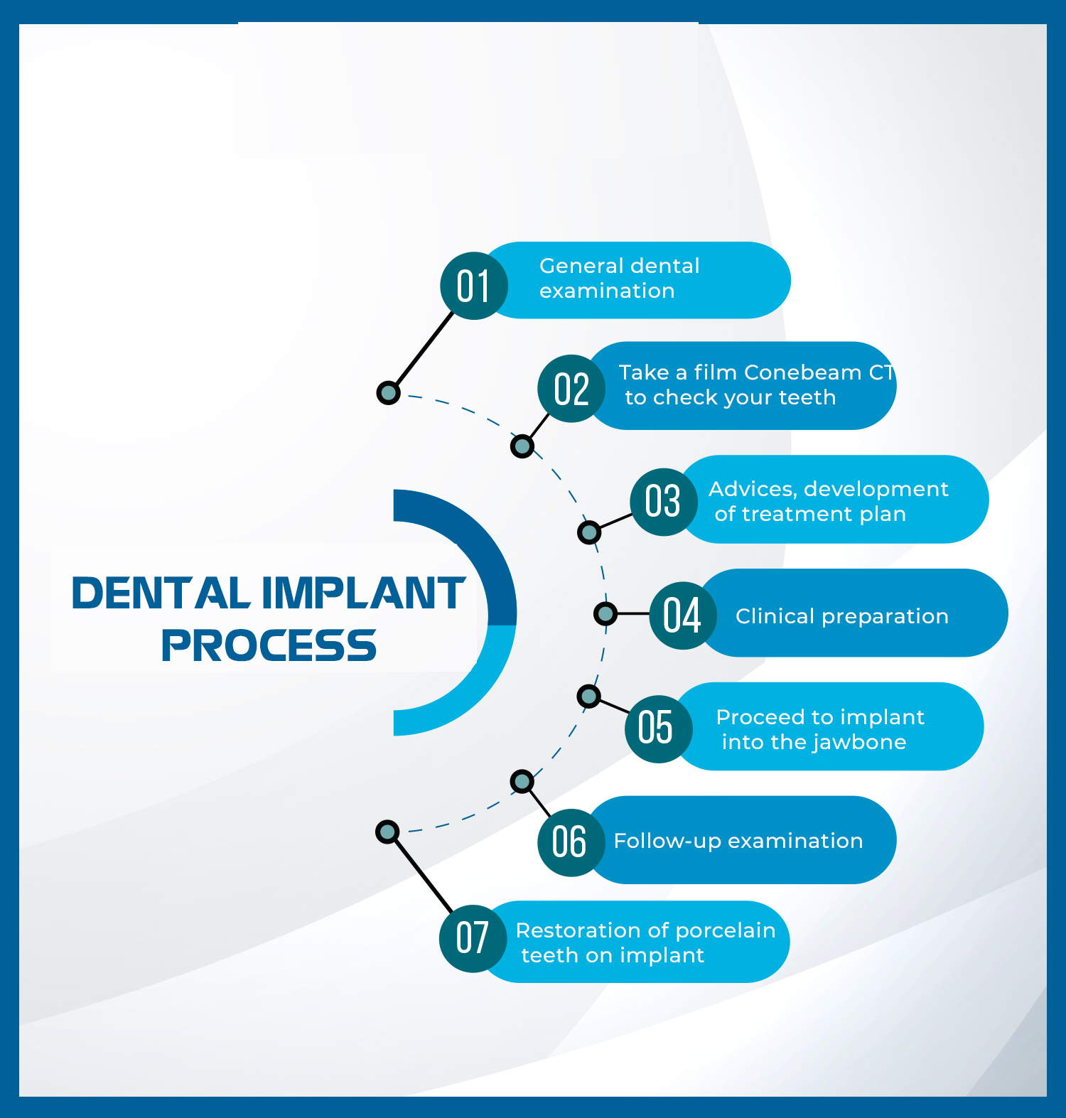 process of dental implant