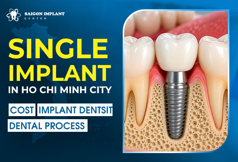 Single Implant single implant