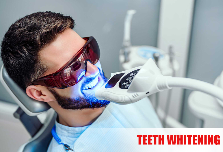 teeth whitening