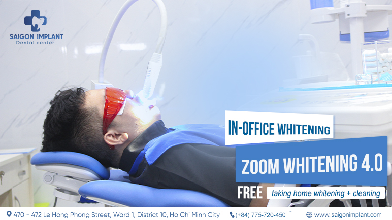 Teeth Whitening Professional Process And Cost Saigon Implant Dental Clinic All On 4 In Vietnam 7329