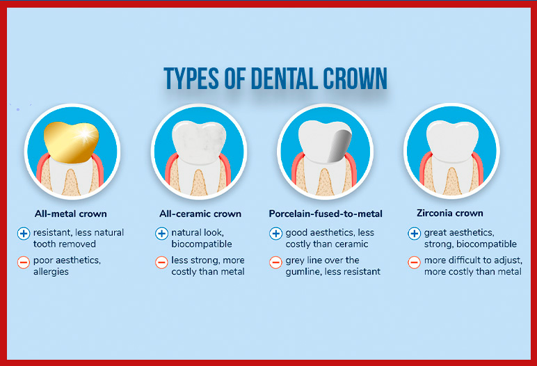 type of dental crown