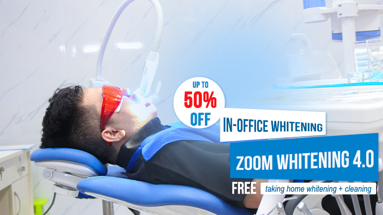 teeth whitening promotion 