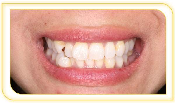 Before image