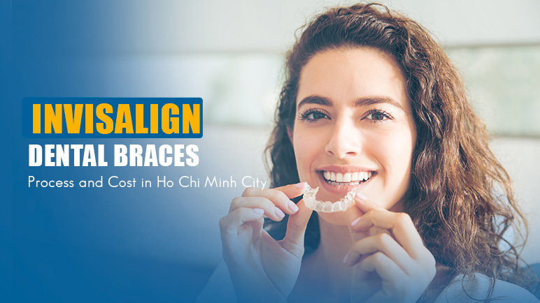 Invisalign Dental Braces: Process and Cost in Ho Chi Minh City