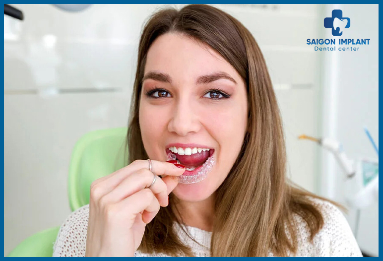 Invisalign dental Braces