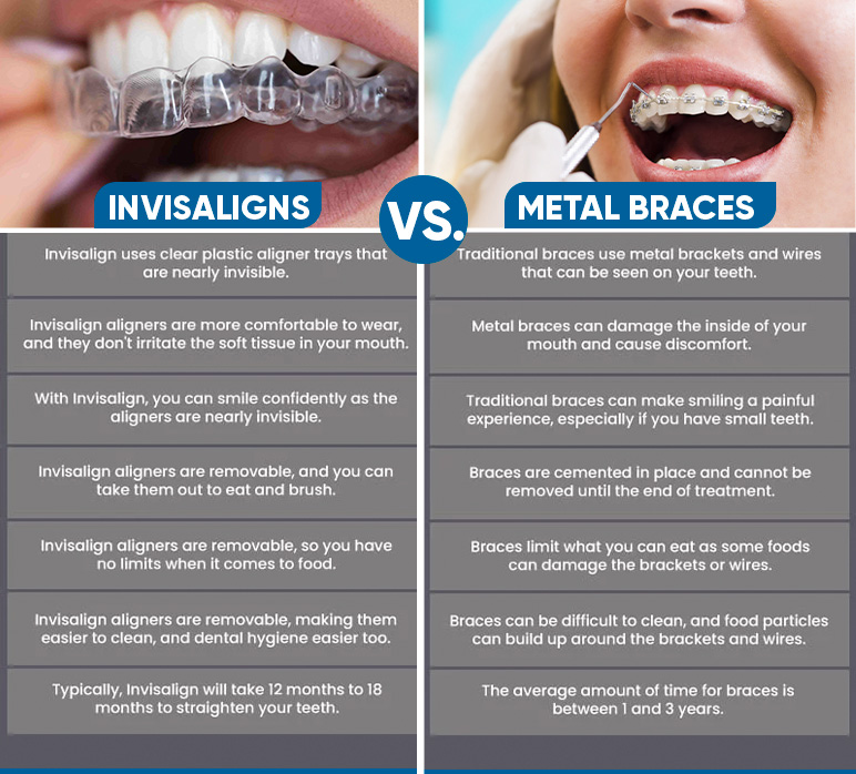 invisaligns vs metal braces