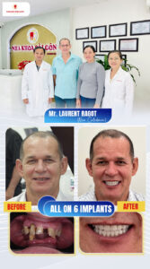 best dental implant hcmc