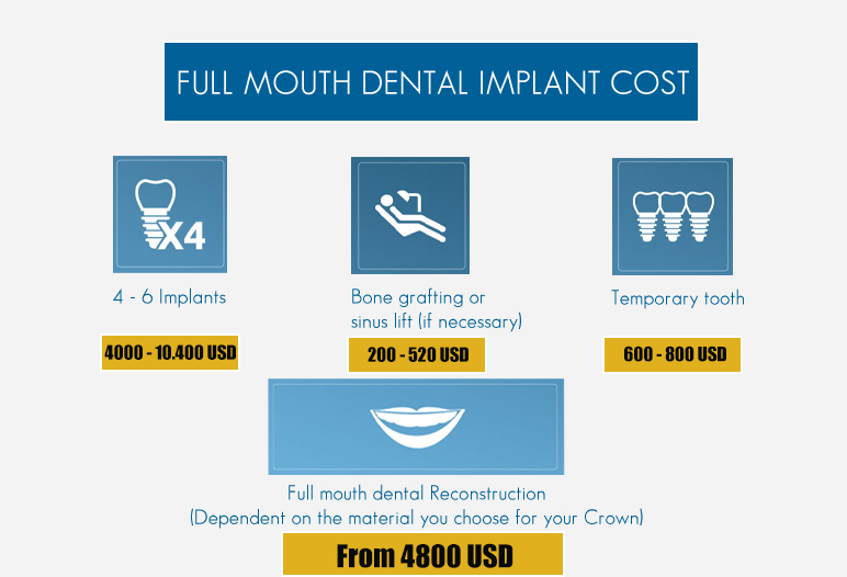 full mouth dental implants cost