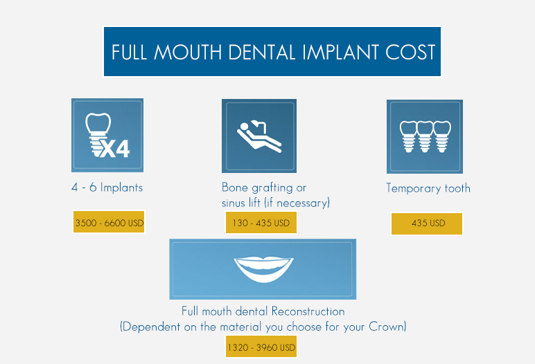 cost of full mouth dental implant