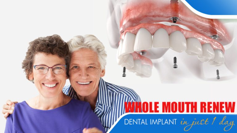 Whole mouth renew Dental Implants in just 1 day in Vietnam - Saigon ...