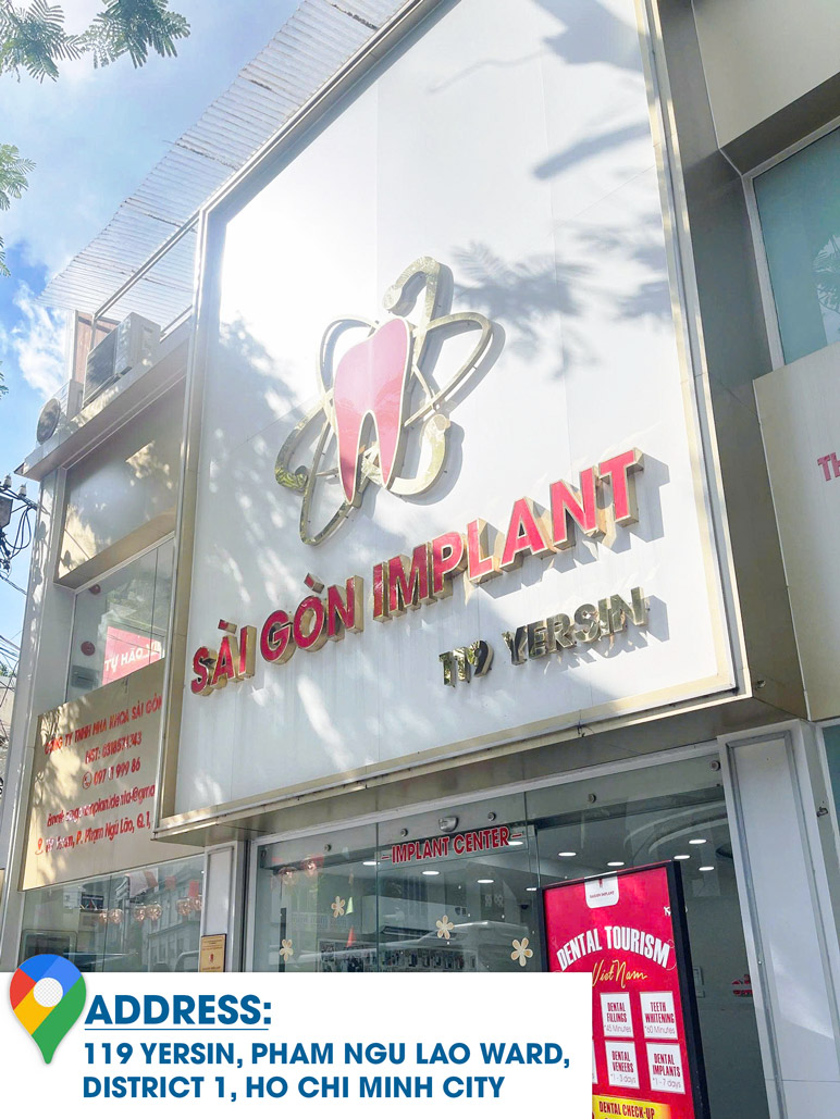 Saigon Implant Center In Ho Chi Minh City best implant clinic ho chi minh
