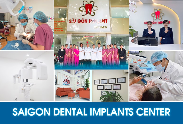 saigon dental implants center