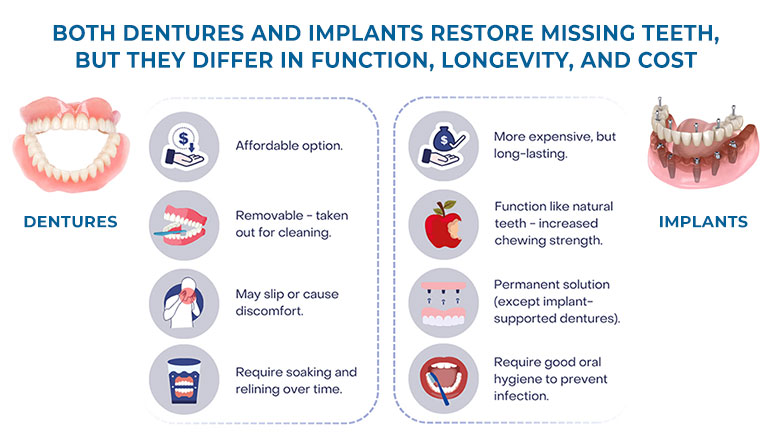 "Are dental implants worth it?