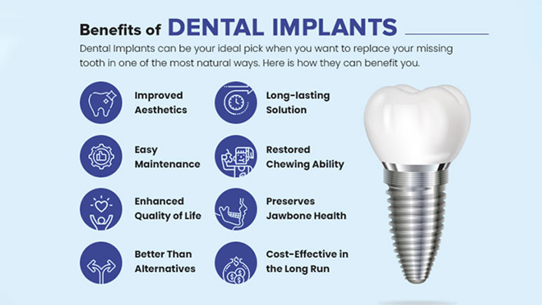 The benefits of dental implants