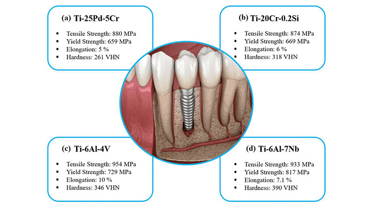 Various titanium alloys used in dental implants and their associated mechanical properties