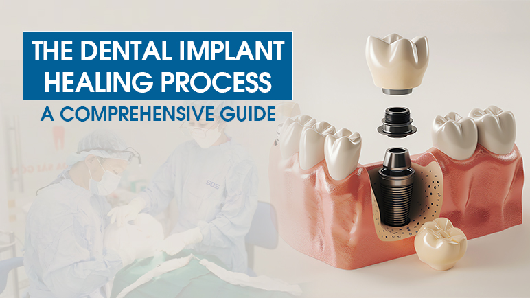 dental implant healing process