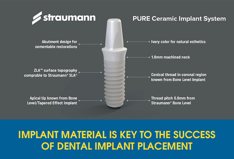 dental implants placement