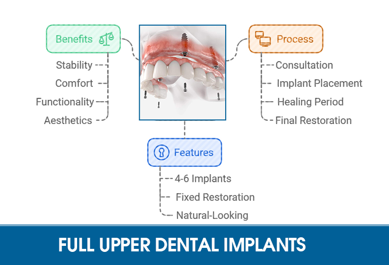 full upper teeth implants