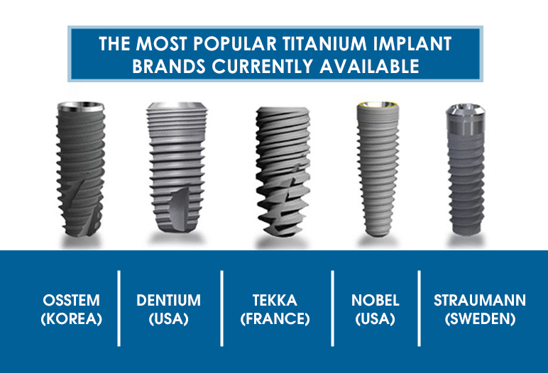 popular titanium dental implants