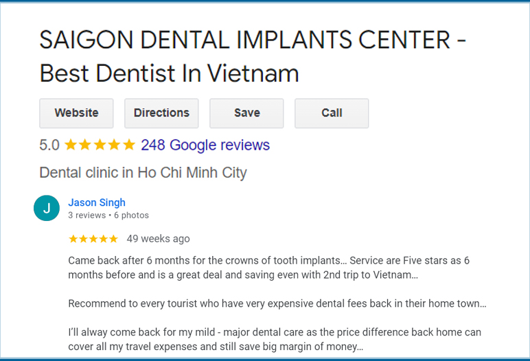 Review of full upper dental implants