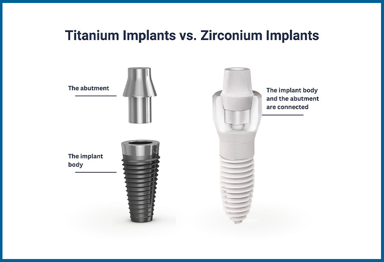 Zirconia implants and titanium implants