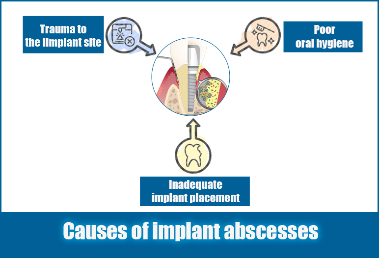 Causes of implant abscesses