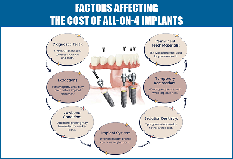 4 on one dental implants cost