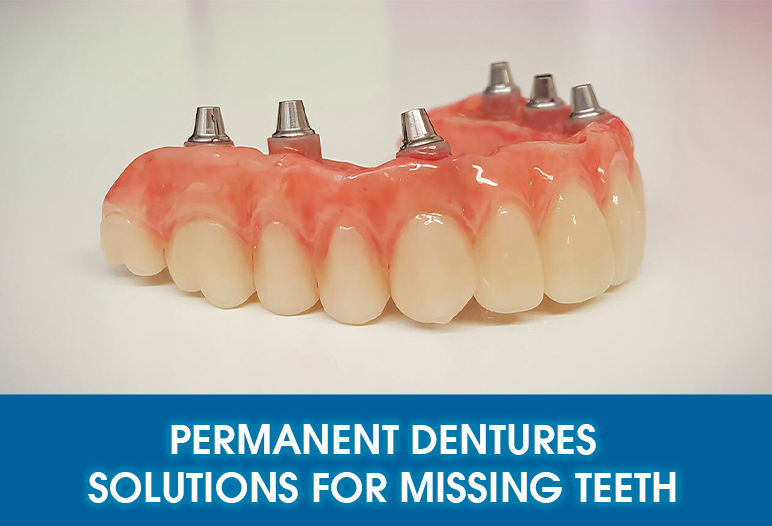 perm dentures