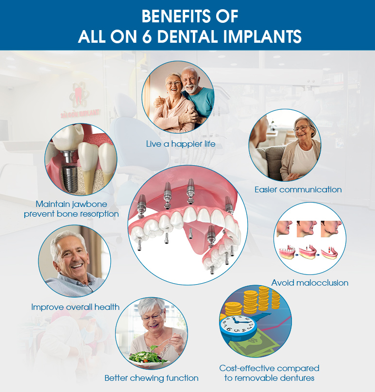 benefits of dental implants