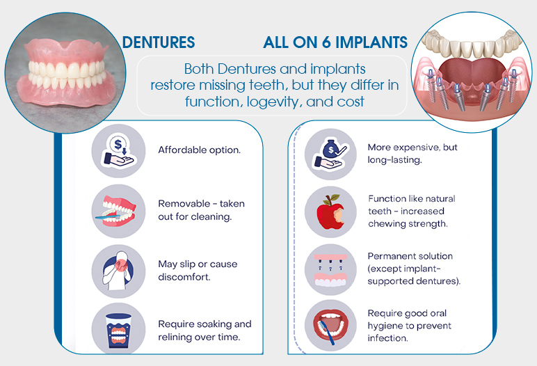 comparision dentures with all on 6 implants