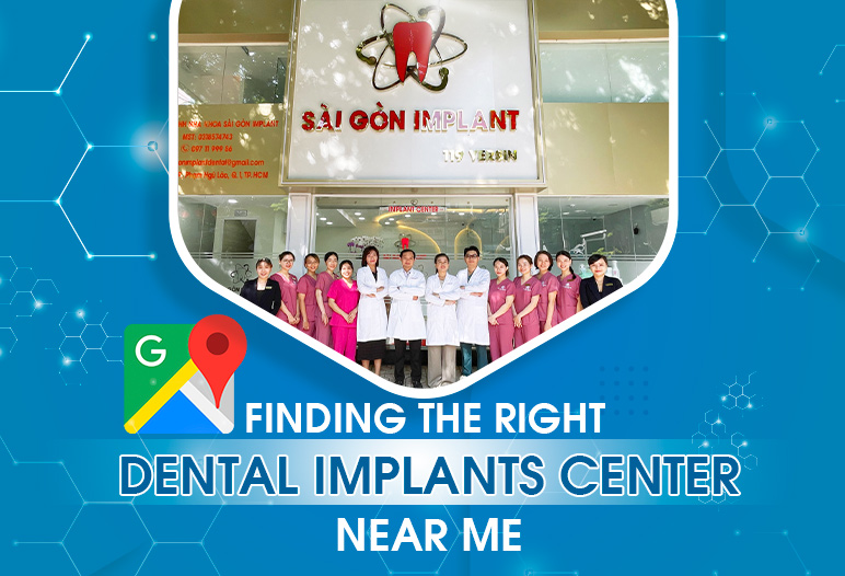 dental implants center near me