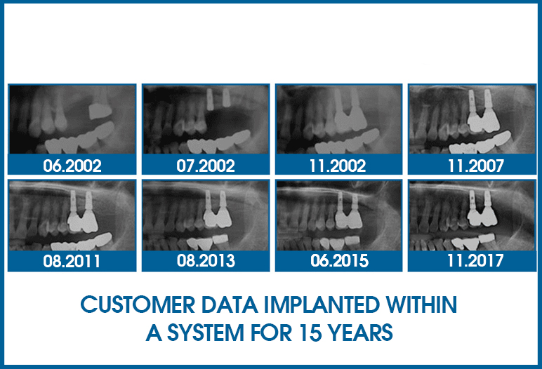 how long can a dental implant last